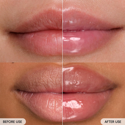 Squalane + Ceramide Barrier Care Lip Balm