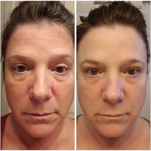 💧✨NAD+ EGF Firming Essence,Creating youthful skin